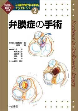 弁膜症の手術 NOA-webSHOP | 中山書店