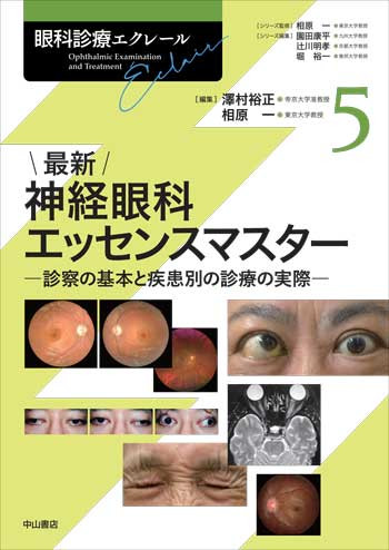 最新 神経眼科エッセンスマスターー診察の基本と疾患別の診療の実際 1746