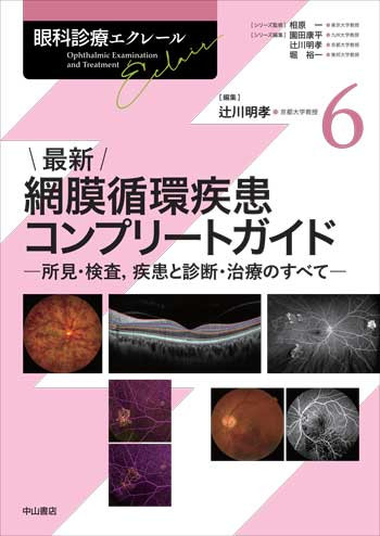 最新 網膜循環疾患コンプリートガイド－所見・検査，疾患と診断・治療のすべて 1750