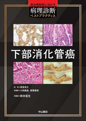 下部消化管癌 NOA-webSHOP | 中山書店